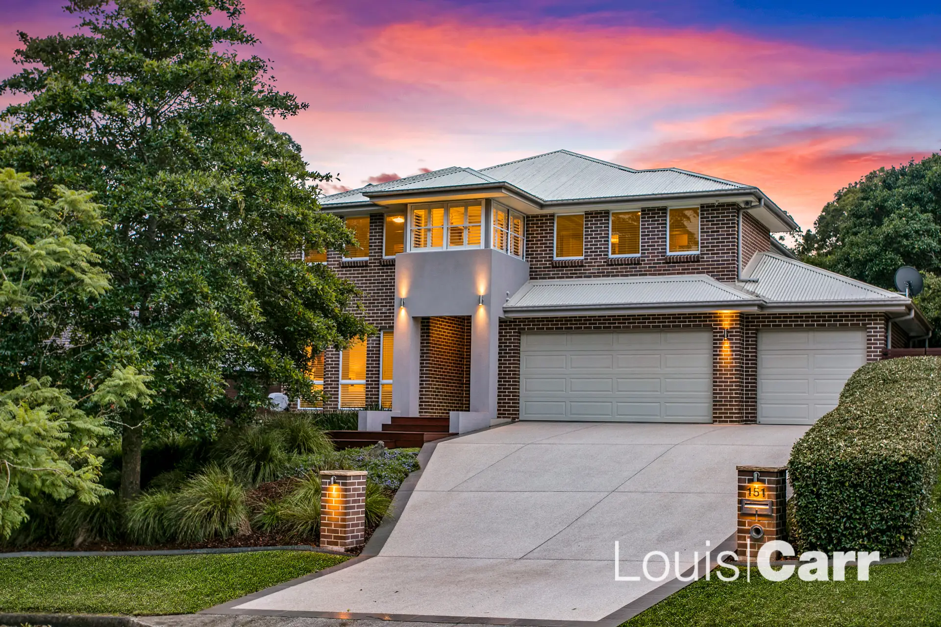 151 Oratava Avenue, West Pennant Hills NSW, West Pennant Hills - Image 1